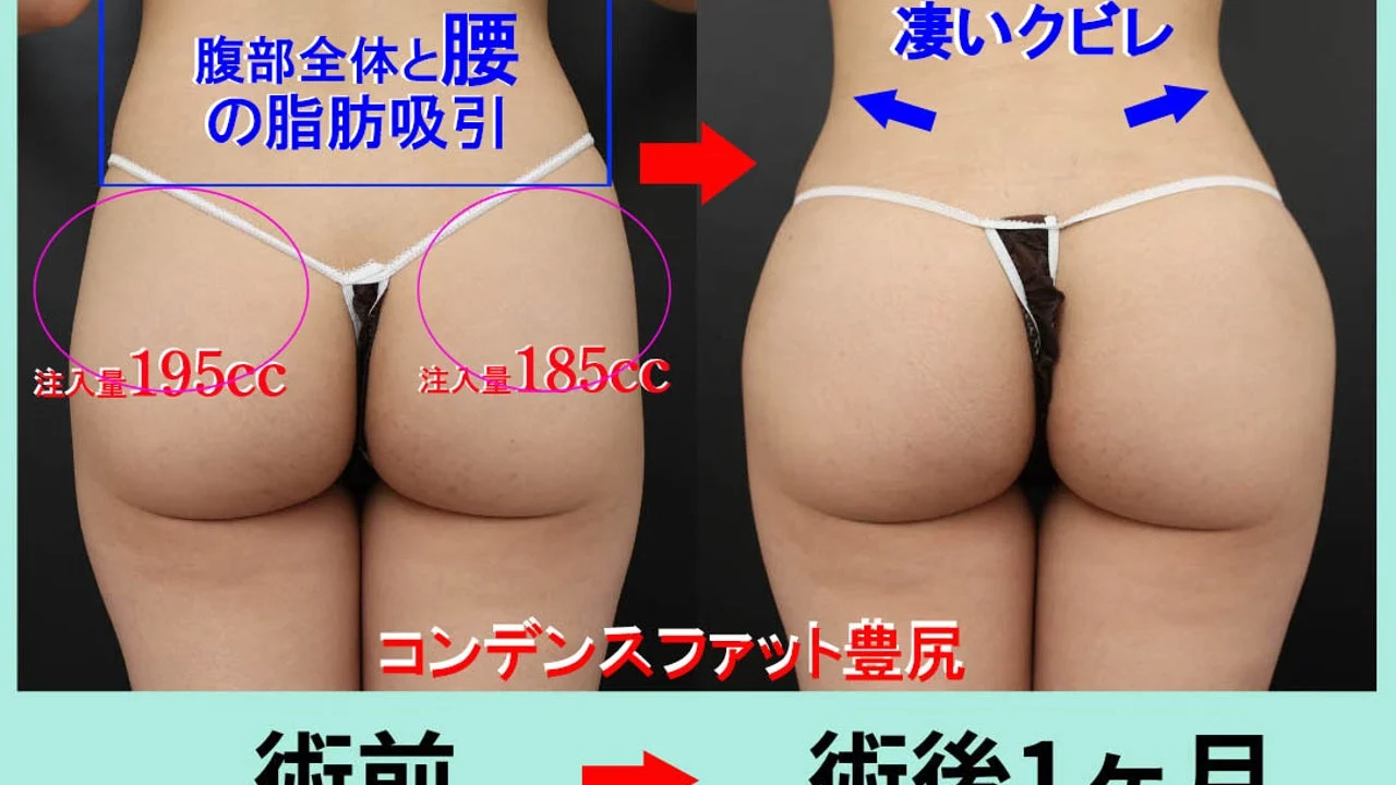 コンデンスリッチ豊尻（ほうこう）で、お尻をヒップアップして、大きくて丸い形に！